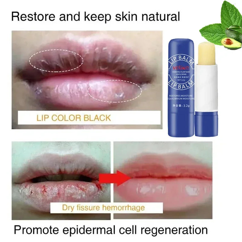 Remove Dark Lip Balm Exfoliating Dead Skin Fade Lip Line Lighten Melanin Lip Mask Moisturizing Brighten Repair Lip Care Product