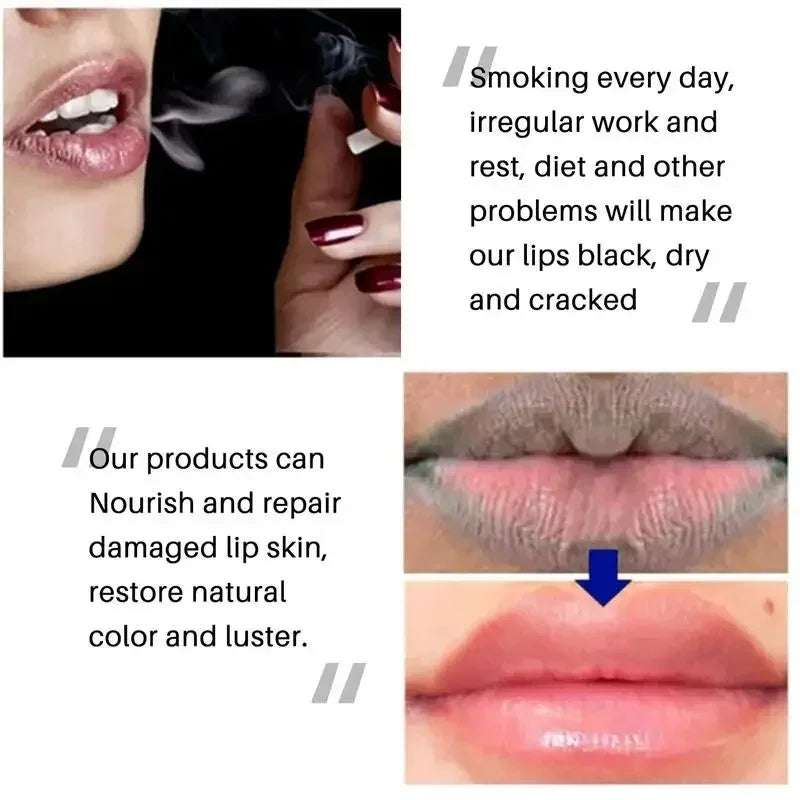 Remove Dark Lip Balm Exfoliating Dead Skin Fade Lip Line Lighten Melanin Lip Mask Moisturizing Brighten Repair Lip Care Product