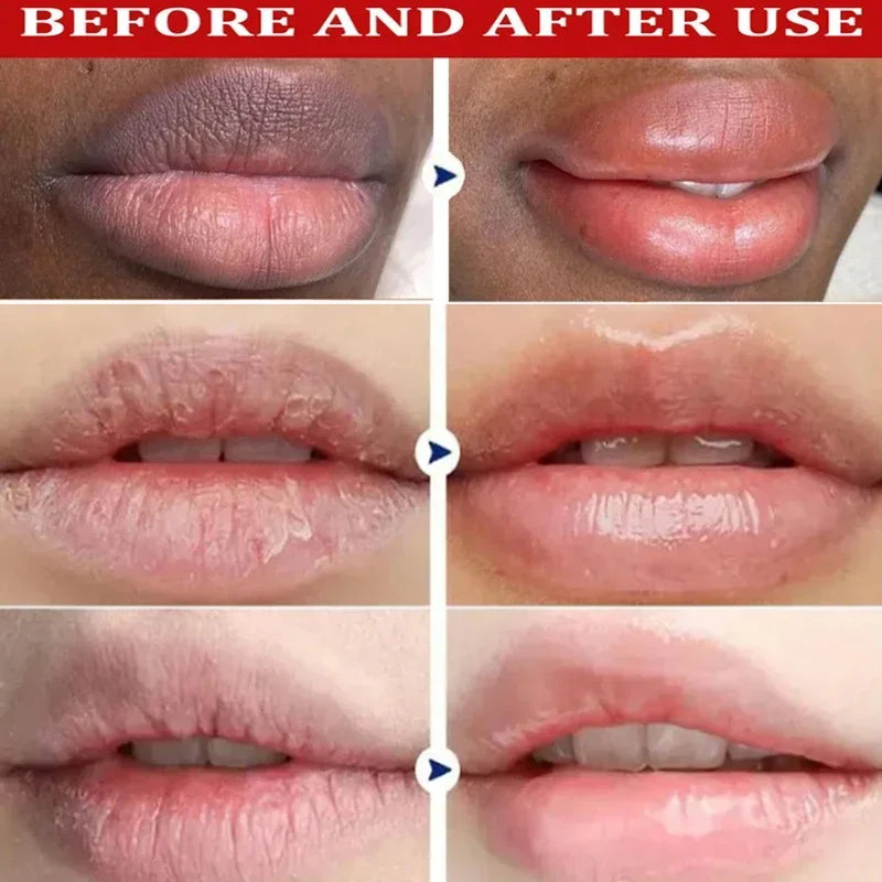 Remove Dark Lip Balm Exfoliating Dead Skin Fade Lip Line Lighten Melanin Lip Mask Moisturizing Brighten Repair Lip Care Product